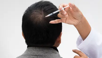 GFC Hair Loss Treatment in Bhubaneswar