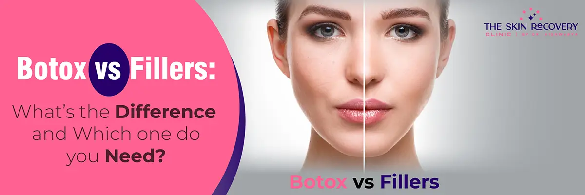 How to Remove Acne Scars Permanently