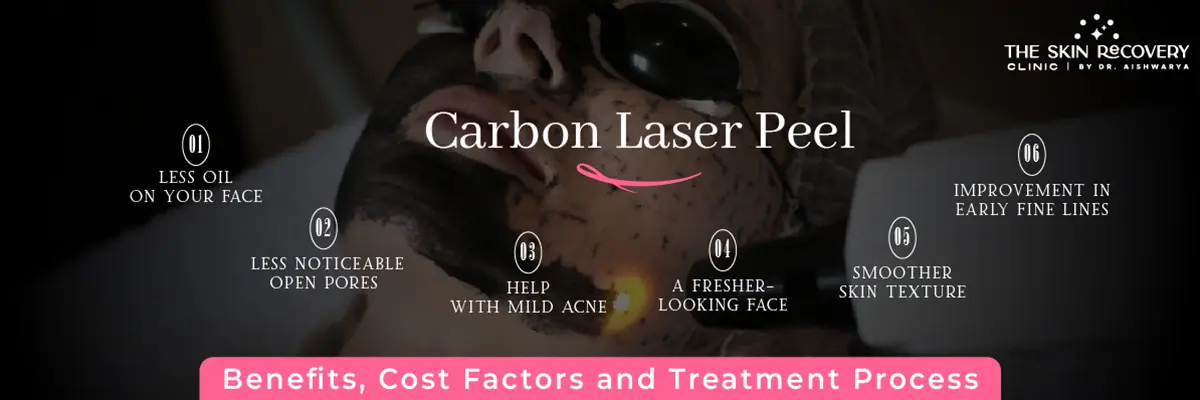 Carbon Laser Peel Treatment for Clearer Skin