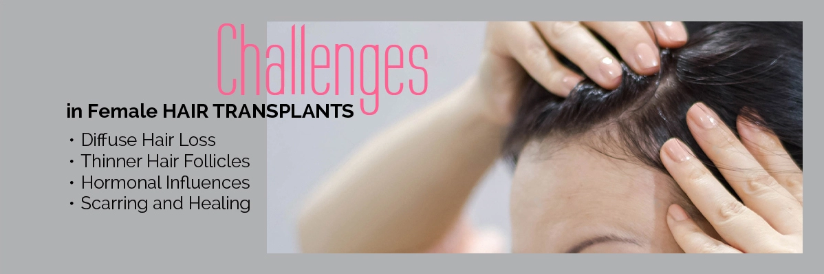 Female Hair Transplant Challenges