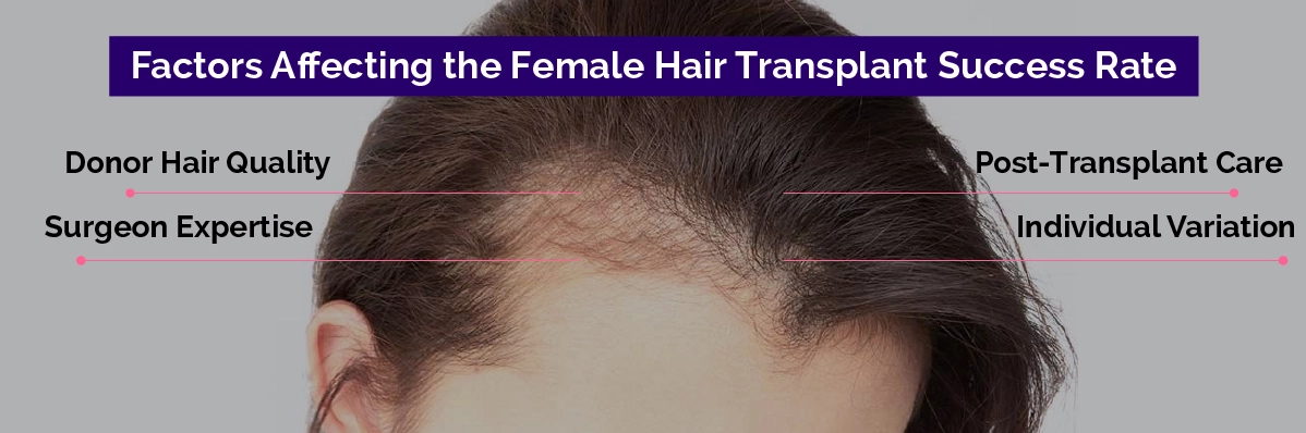 Factors Affecting the Female Hair Transplant Success Rate