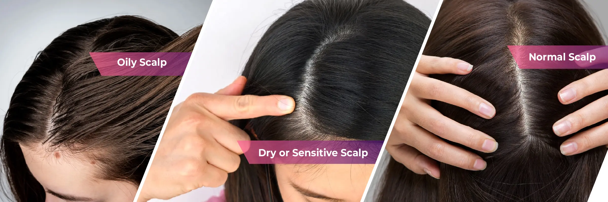 How Often Should You Detox Your Scalp