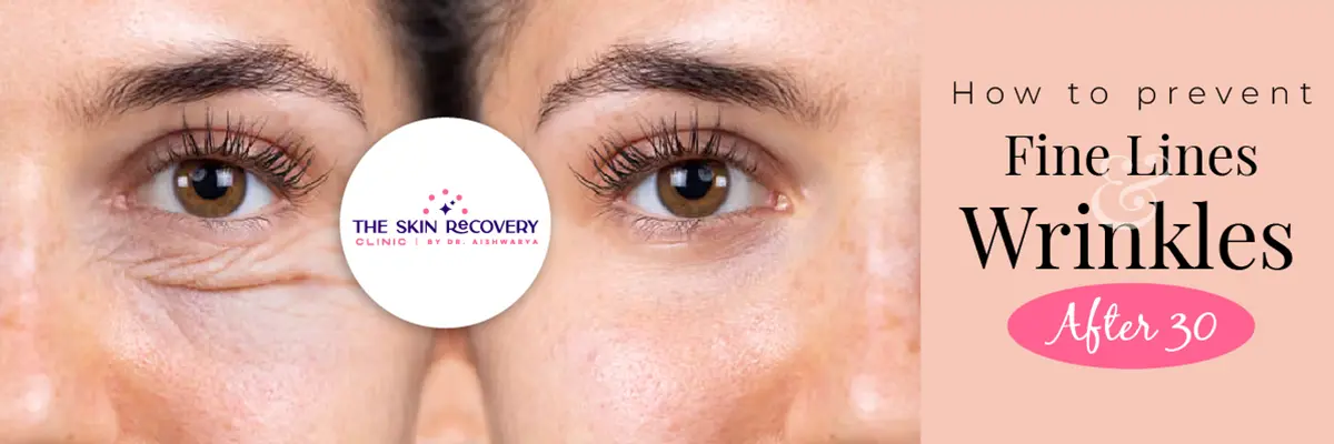 How to Prevent Fine Lines and Wrinkles