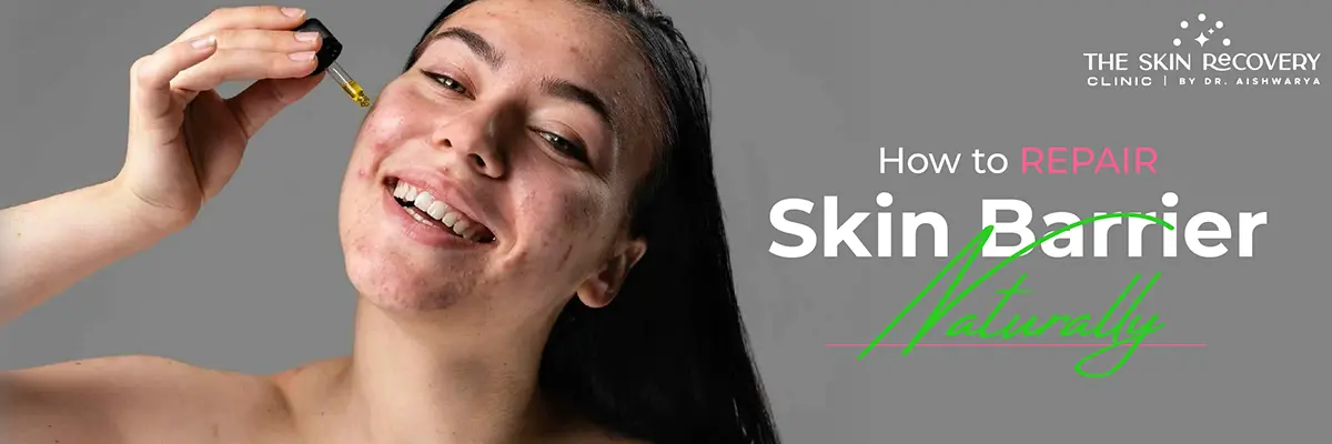 How to Repair Skin Barrier Naturally