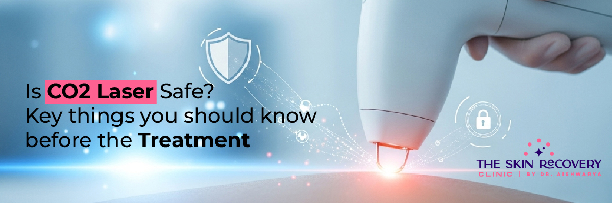 Is CO2 Laser Safe