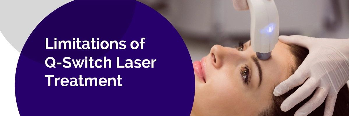 Q-Switch Laser Treatment