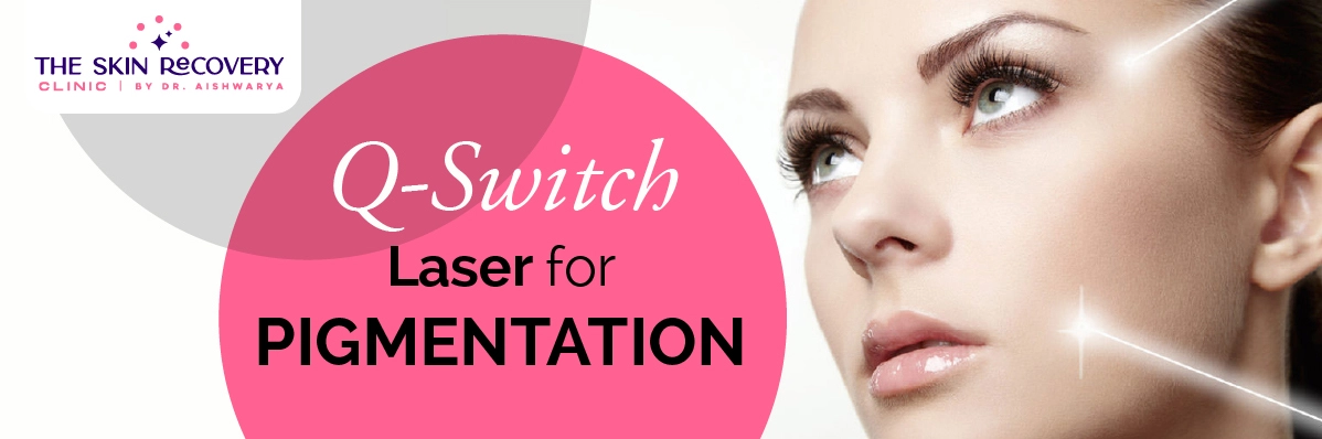 Q-Switch Laser For Pigmentation
