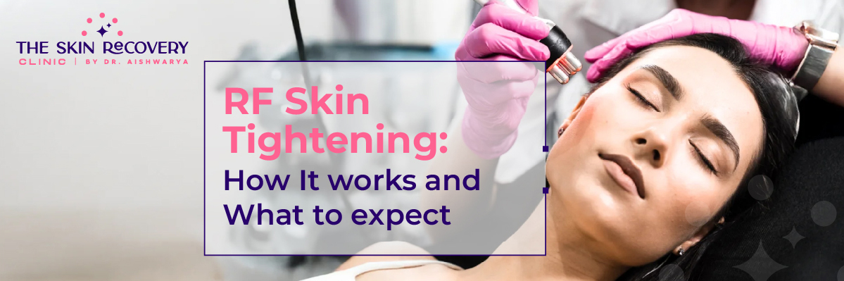 RF Skin Tightening