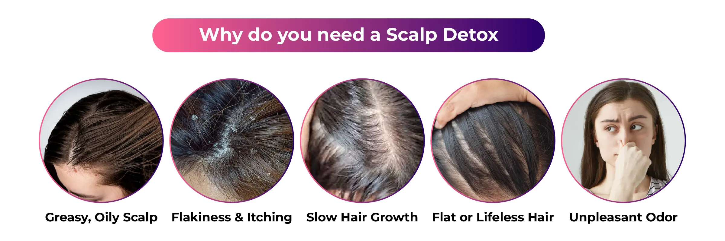 Why Do You Need a Scalp Detox