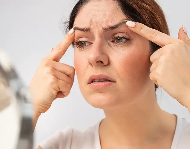 Carbon Peel for Rosacea Treatment