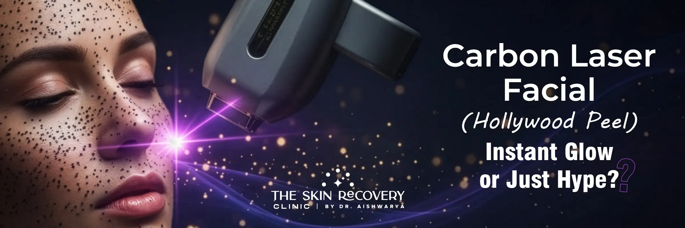 Carbon Laser Facial (Hollywood Peel)