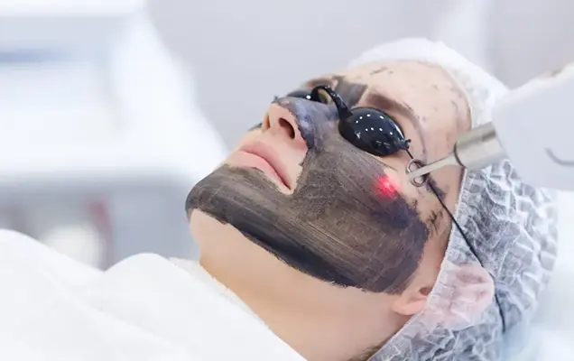 carbon laser treatment bhubaneswar