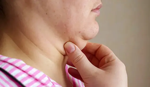 Causes of Double Chins