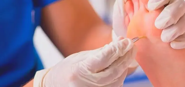 Corn Removal Surgery Bhubaneswar