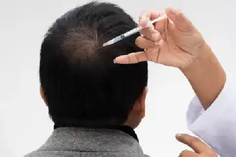 GFC Hair Loss Treatment in Bhubaneswar