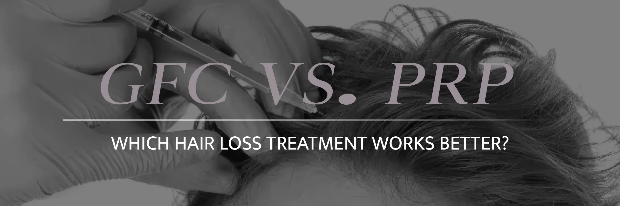 GFC vs PRP Hair Loss Treatment