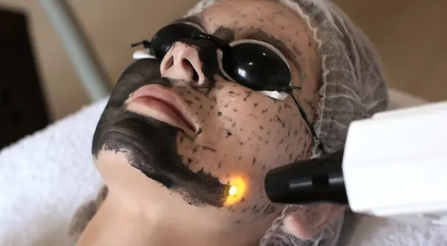 hollywood peel treatment procedure