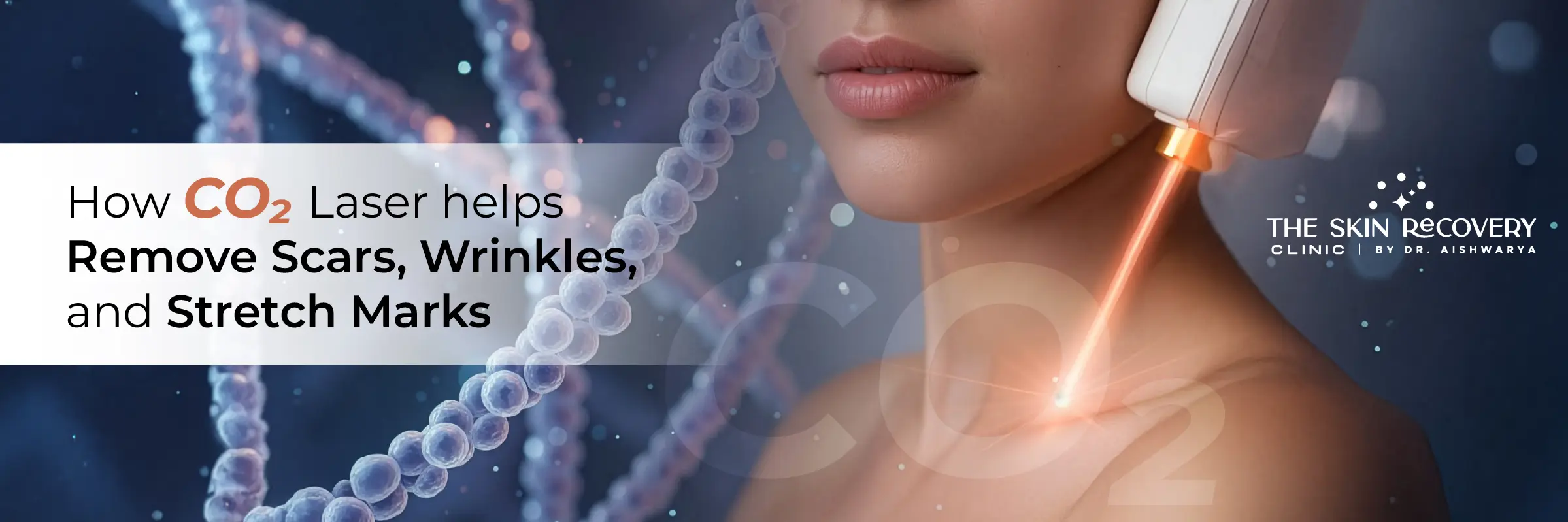 CO₂ Laser Helps Remove Scars, Wrinkles, and Stretch Marks