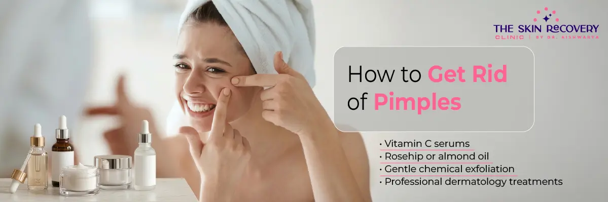 How to Get Rid of Pimples