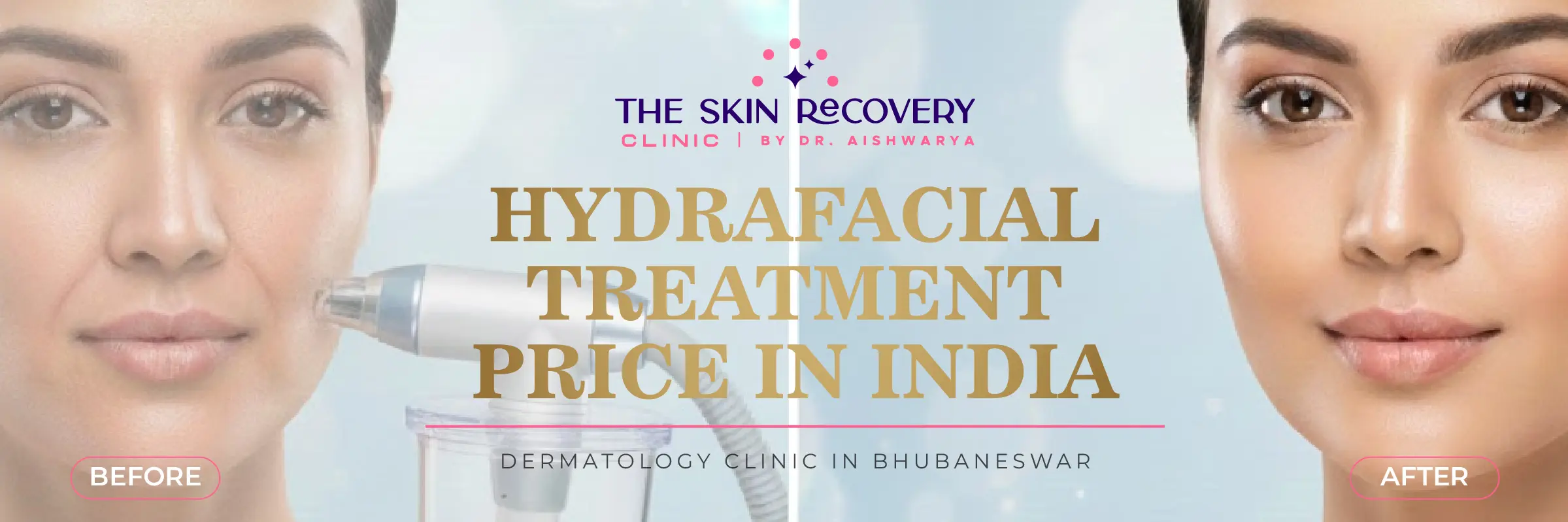 Hydrafacial Treatment Price in India
