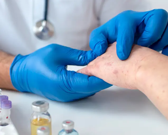 Allergy Treatment in Bhubaneswar