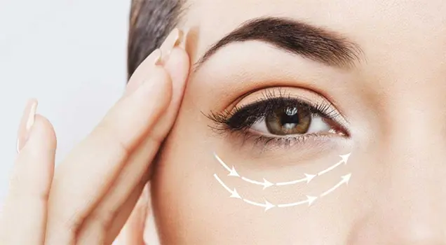 Techniques Used for Eye Bags Treatment Bhubaneswar