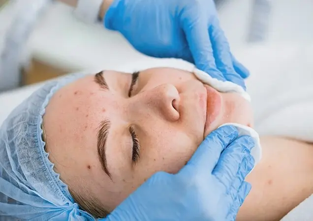 techniques for pigmentation treatment