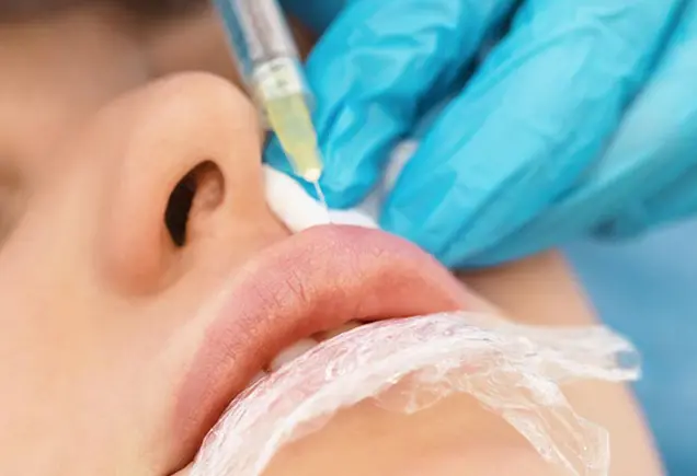 Carbon Peel for Rosacea Treatment