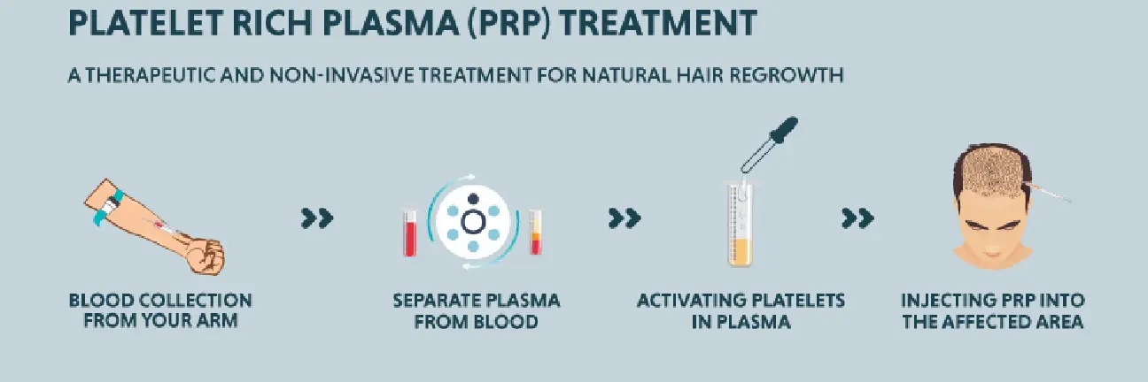 Platelet Rich Plasma PRP Treatment Process