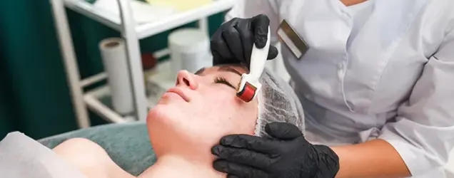 red carpet facial treatment with derma roller device on face