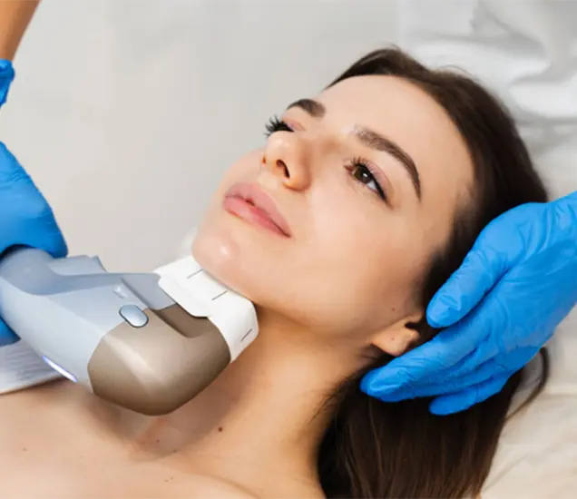 Carbon Peel for Rosacea Treatment