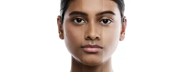techniques used for skin whitening