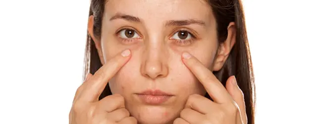 Techniques Used for Eye Bags Treatment Bhubaneswar