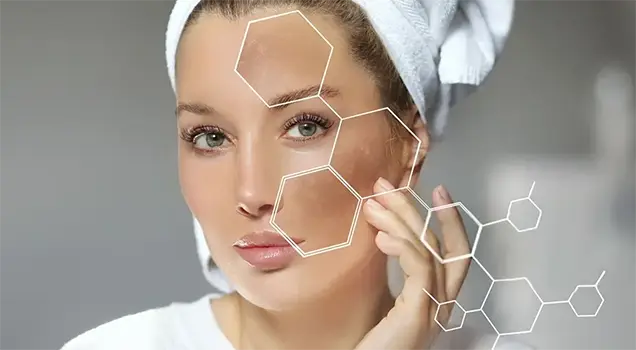 techniques for melasma