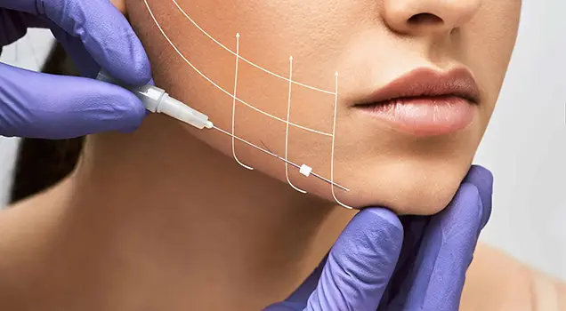 Best Thread Lift Treatment in Bhubaneswar