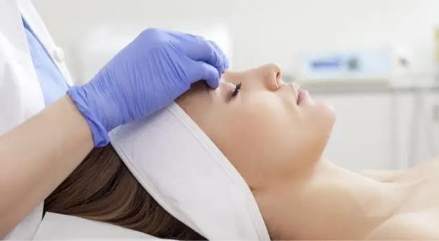 Carbon Peel for Rosacea Treatment
