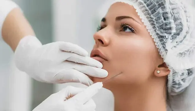 After Thread Lift Treatment