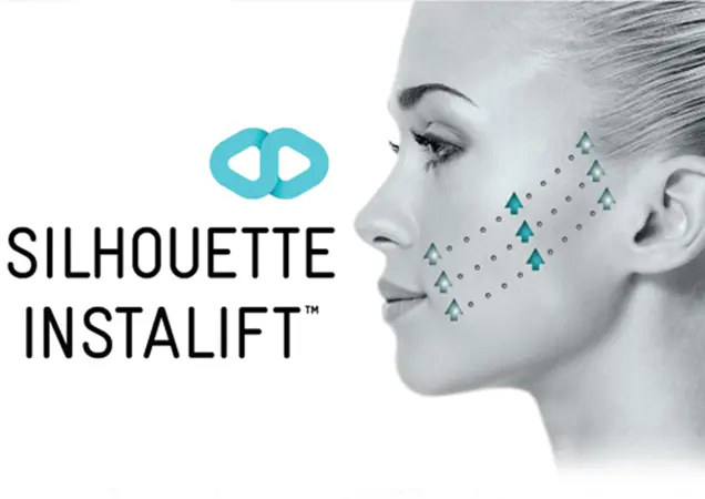 Best Thread Lift Treatment in Bhubaneswar