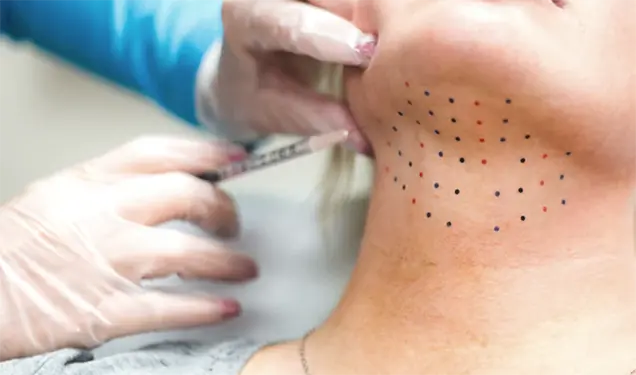 Causes of Double Chins